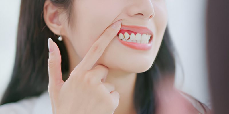 Top 10 Ways to Prevent Gum Disease and Maintain Oral Health_FI