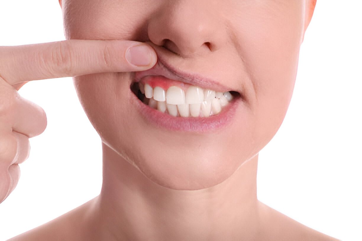 Navigating Gum Disease Treatments in Texas: Your Lubbock Dental Care Guide_1