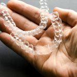 How Lubbock Dental Care Makes Invisalign the Go-To Solution for Dental in Lubbock, Texas_FI