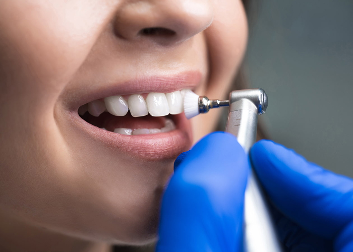 Dental cleanings & Checkups