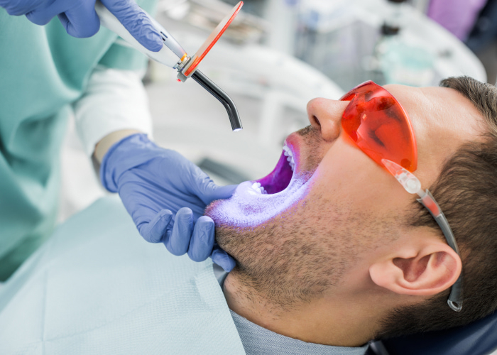 Teeth Whitening