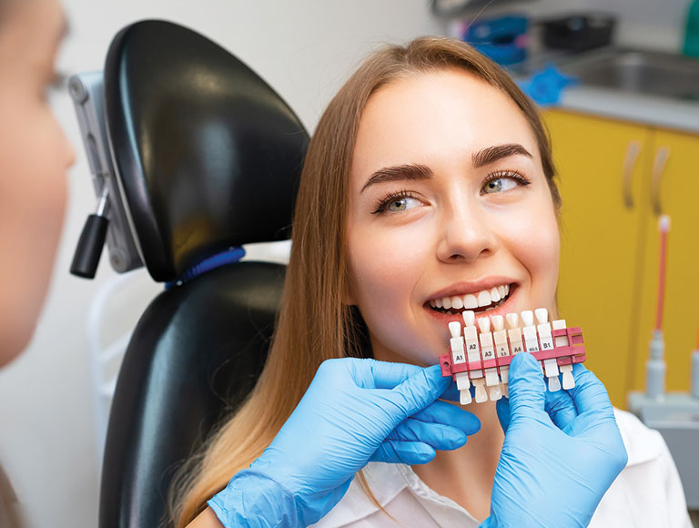Consider Veneers