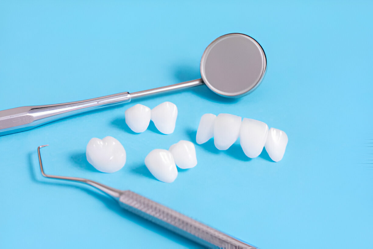 How to Care for Porcelain Veneers: Top Maintenance Tips from Leading Dental Experts in Lubbock_FI